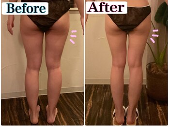 トータルビューティーサロン 凛/細身のパンツをはきこなす