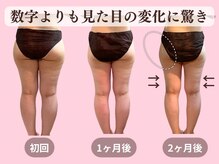 ヨサパーク 美キレイ 仙台店(YOSAPARK 美 Kirei)