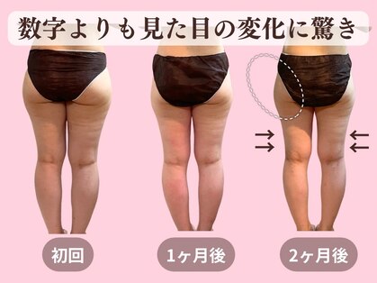 ヨサパーク 美キレイ 仙台店(YOSAPARK 美 Kirei)の写真