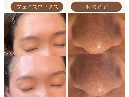 はなさくら あざみ野店の写真