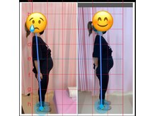 マイティー整骨院 ココア(CoCoa)/マタニティ整体