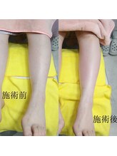 ドクターネイル爪革命 長野店/【トータルフットケア】/フット