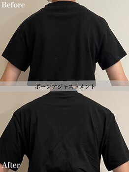 アール アンド ビューティーサロン(Ｒ＆ BeautySalon)/臍帯血エクソソーム