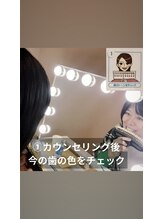 ホワイトニング ビューティー 南魚沼店(whitening beauty)/カウンセリングと歯の色を確認