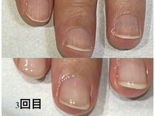 グレースレディ/伸びているのわかりますか？