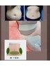 【県内希少最新】360℃冷却で細胞へアプローチ！脂肪冷却 腹 3カップ 　¥8500