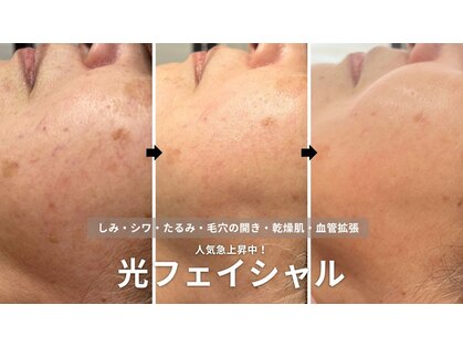 シャイニーの写真