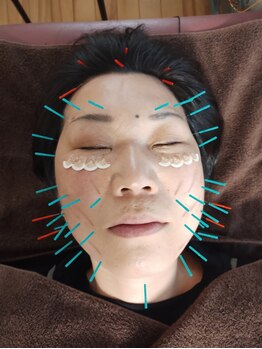 しまうら鍼灸院の写真/【完全個室★メンズOK！】その日の体調・年齢・お悩みに合わせた“あなただけ”のケアをご提供◎