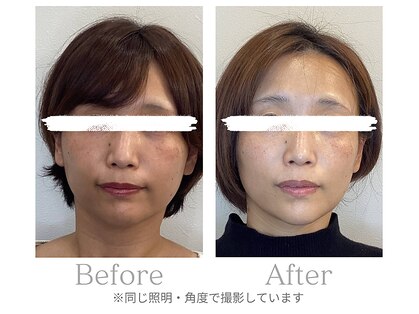 ブルースターの写真