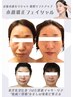 写真映え抜群!中顔面短縮◎目鼻立ちスッキリ3D小顔矯正+ヘッド&首肩ほぐし