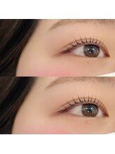 デュオ(duo)/メーテルロッド