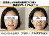 極上エイジングケア☆40代～悩み全解消【最高級プレミアム若肌コース】¥8500