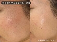 ジュパール(je pars)/プロセルセラピーズ