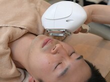 クレアシオン エム(Cre'ation M)/男性ヒゲ脱毛