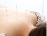【初回】コリ、痛み鍼灸コース（マッサージ付）…45分～60分(1部位)