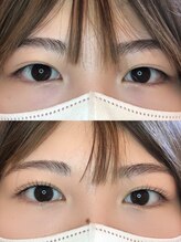 リガール(LIGAR)/まつげパーマ