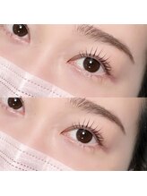 ベル(Belle)/ストレートデザイン