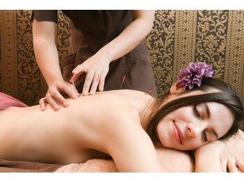 横濱 イヲリ(IORI)/お体の鍼灸