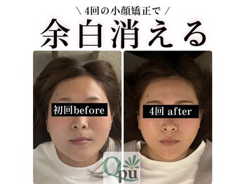 キュープ 高崎店(Qpu)/小顔頭蓋骨矯正＋リンパケア