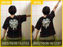 整体院 元 光の森店の雰囲気（#整体院　#肩のビフォーアフター　#肩の施術）
