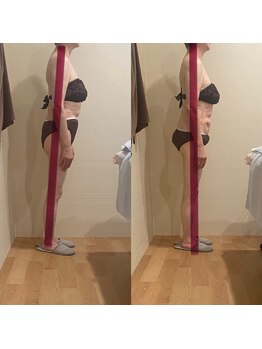 トトノエル(TOTONOEL)/腰痛改善