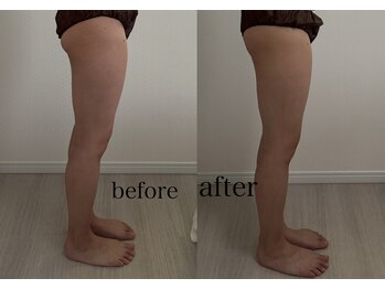 ラ セメリエ(La S'aimeriller)/経絡リンパ+バンテージパック