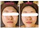エスネイル(es.nail)の写真/【はじめての方限定】フェイシャル体験コース（９０分）