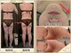 美ネージュの写真