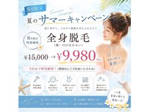 ベルーナ(Belluna)