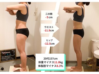 ラ コンシェル 町田店/Before After【町田店】