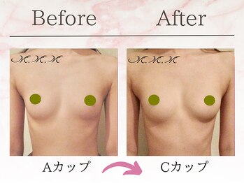 エムエムエム 表参道Luxeサロン(M.M.M)/【バストアップ例】　A→Cカップ