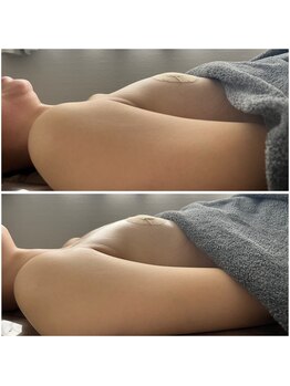 モア(moa)/1回での変化