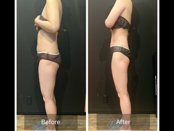 グラシアス サロン(GRACIAS SALON)/人気NO1ガッツリ痩身エステ