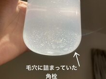 ココモンド(COCOMONDO)/ハイドロ毛穴洗浄/毛穴/毛穴洗浄