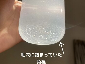 ココモンド(COCOMONDO)/ハイドロ毛穴洗浄/毛穴/毛穴洗浄