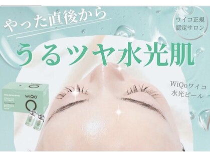 クロエココ(Chloe.cocoo)の写真
