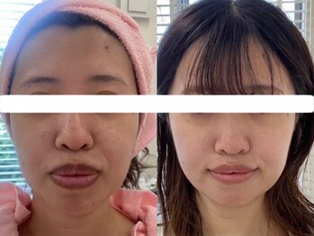 サクラ 本厚木駅前店(SAKURA)/店内出入り口に検温器設置