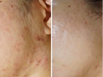 マリヴェリーテ(Mari verite)/内側×外側から本気の改善