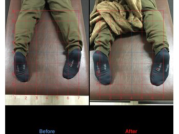 ストレチックス 近江八幡店/姿勢改善ビフォーアフター1回