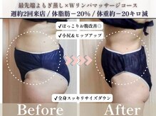 ヨサパーク プラーナ 千歳烏山店(YOSA PARK)/ビフォーアフター