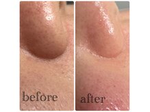 ビューティービューティー(BEAUTY BEAUTY)の雰囲気（美容成分でできた艶肌ワックス）