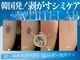 肌イズム 守谷店(肌ism)の写真