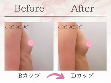 エムエムエム 表参道Luxeサロン(M.M.M)/【バストアップ例】　B→Dカップ