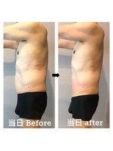 伊達男/フォースカッター 事例