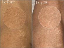 ピンクアンドプラウドサロン 横浜(Pink& Proud Salon)/ローマピンク【膝】