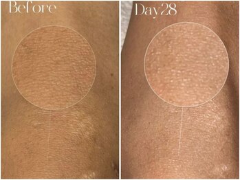 ピンクアンドプラウドサロン 横浜(Pink& Proud Salon)/ローマピンク【膝】