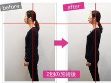 堺駅で腰痛・骨盤の歪み・反り腰・産後の歪みに特化した施術◎
