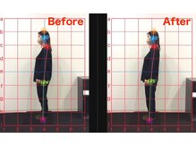 ケアルーム 湘南台(CARE room)/施術効果写真☆（before after）