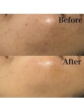 リレイスフクオカ(RelaceFUKUOKA)/セラピール