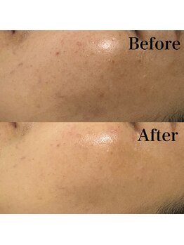 リレイスフクオカ(RelaceFUKUOKA)/セラピール